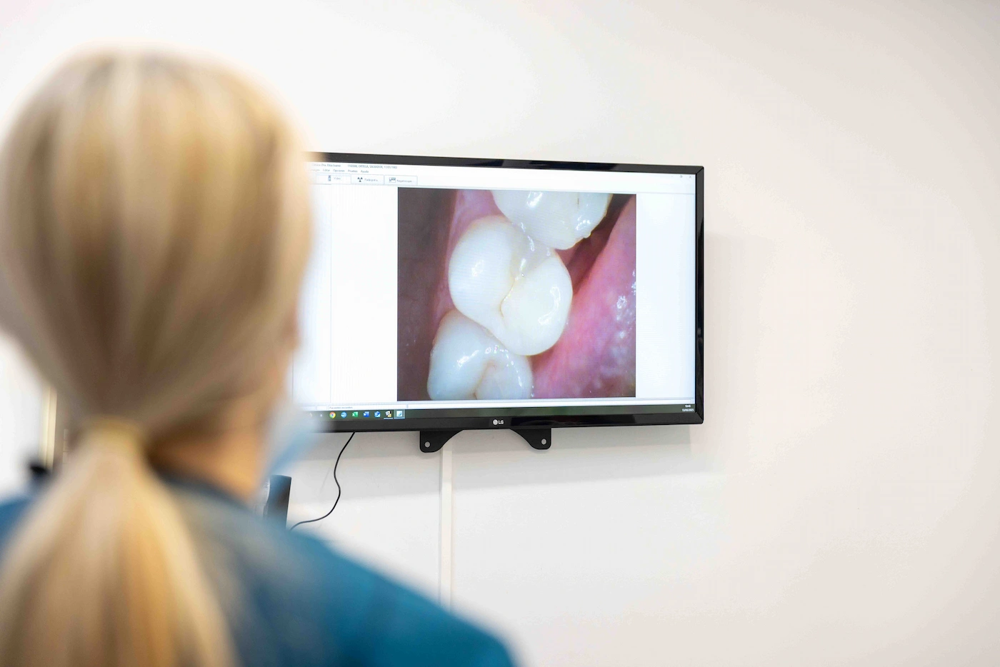 camara-intraoral